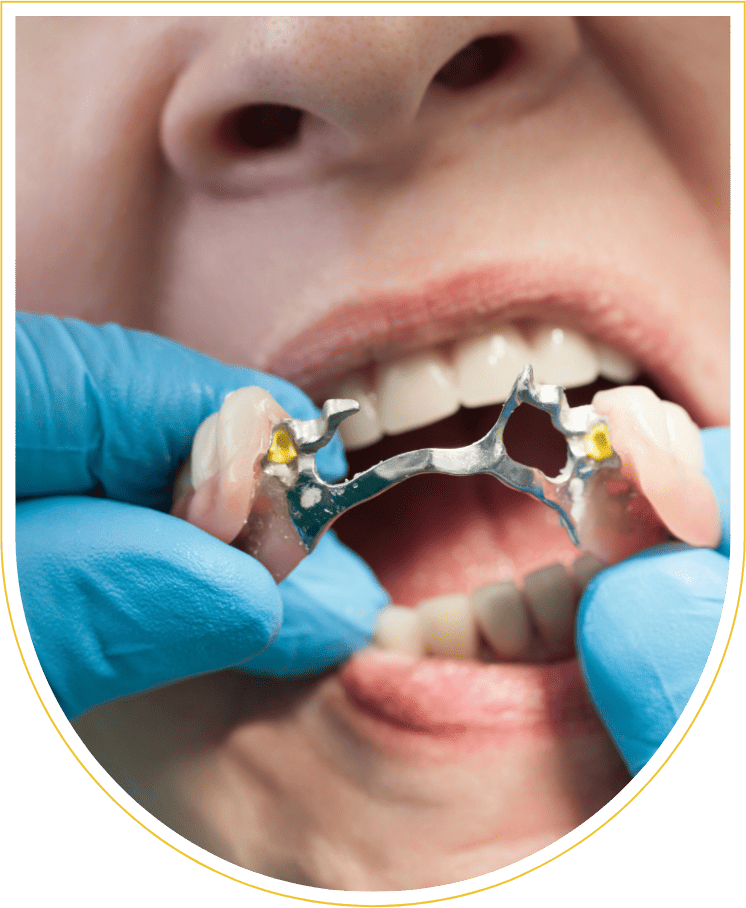 Prótese dentária